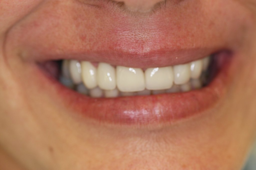 Case Study 1 After Photo