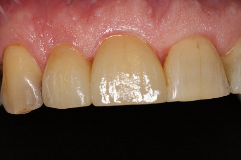 Case Study 3 After Photo