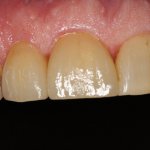 Case Study 3 After Photo