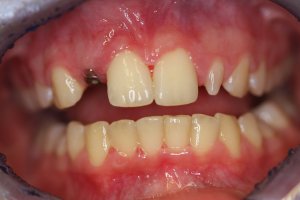 Case Study 5 Before