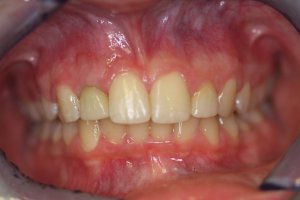 Case Study 5 After