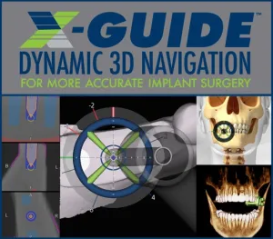 X-Guide infographic